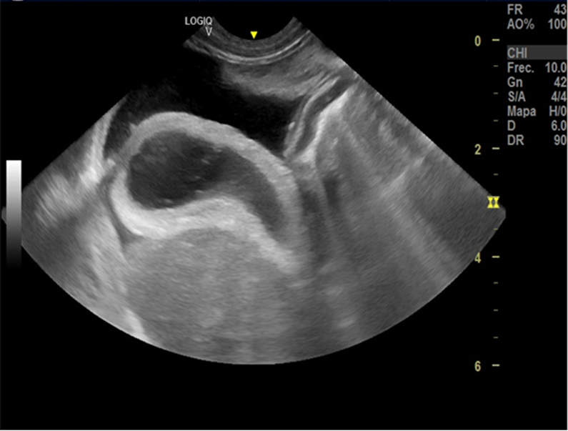 ecografía líquido libre abdominal Leishmaniosis