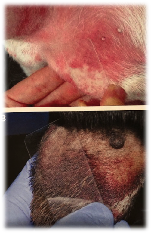 Vasculitis cutanea